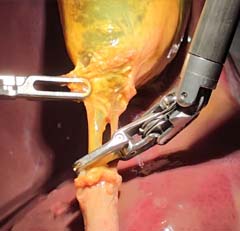 Santhosam Chest Hospital Awards